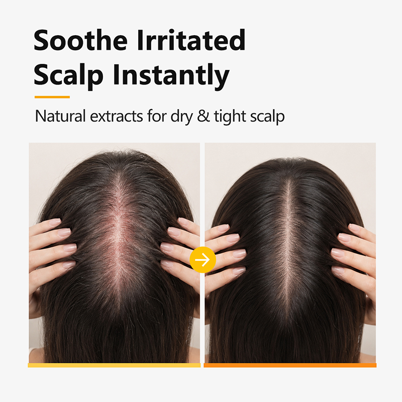 PURC Biotin Peptide Scalp Esse - đánh giá và giá Hair Care Vitamin E