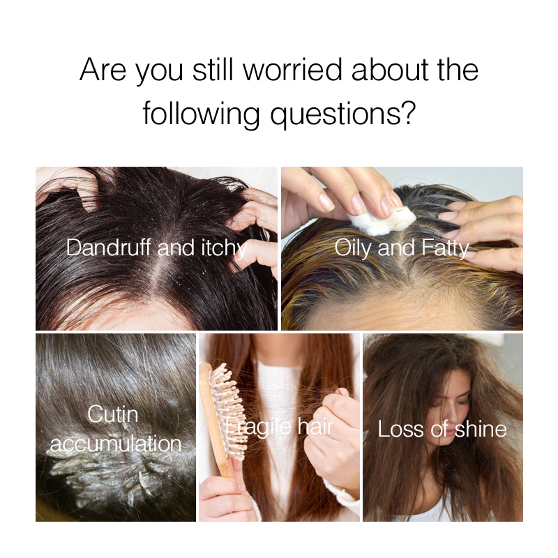 PURC Hair Scalp Treatment Esse - đánh giá và giá Hair Care Normal