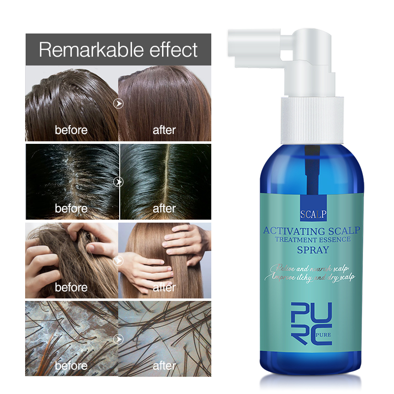 PURC Hair Scalp Treatment Esse - đánh giá và giá Hair Care Normal