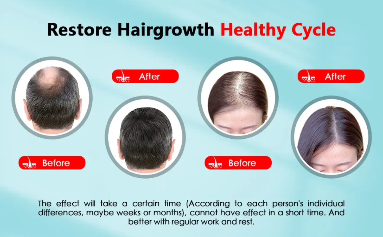 Hair Growth Cap Rechargeable 2 - đánh giá và giá Hair Care Basic